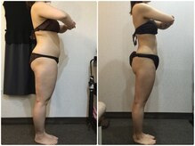 ウェリナ平和堂長久手院/小顔矯正/骨盤矯正/痩身/整体