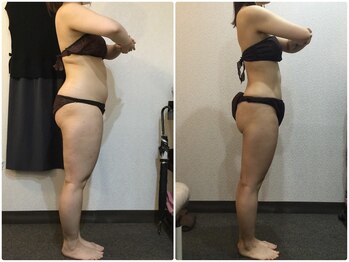 ウェリナ平和堂長久手院/小顔矯正/骨盤矯正/痩身/整体