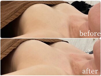 ルナリア ルクス 志木南口駅前店/即日実感!バストアップ