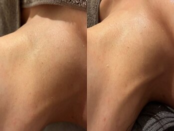 シェリー(CHERIE)/ネックパック