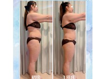 ヨサパーク オリ(YOSA PARK oli)