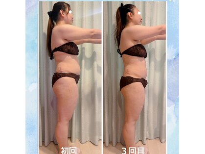 ヨサパーク オリ(YOSA PARK oli)の写真