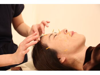 きらり整体/【施術】美容鍼