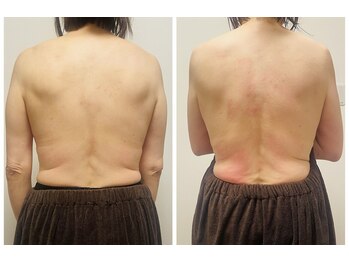 YOSAPARK Lulua/before*after