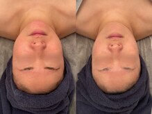 ポーデベロア(Peau des velours)/3月キャンペーン