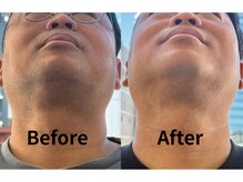 男前製作所 ナゴヤ(NAGOYA)の雰囲気(早くて痛みの少ないSHR方式機器★ヒゲ脱毛・vio脱毛・全身脱毛・)