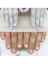 アイネイルズ 布施店(I.NAILS)/深爪/深爪矯正/自爪風ネイル