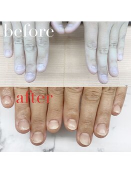 アイネイルズ 布施店(I.NAILS)/深爪/深爪矯正/自爪風ネイル
