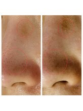 トータルビューティーサロン ナーズ(NAZ)/