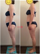 ビューティー サロン ハナ(Beauty Salon hana)/筋膜リリース1回施術効果　横