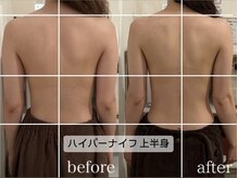 ラコル 京橋店(lacol)/【ハイパーナイフ上半身】