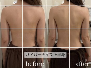 ラコル 京橋店(lacol)/【ハイパーナイフ上半身】