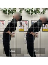 ナオル整体 池袋院(NAORU整体)/骨盤矯正の施術前後