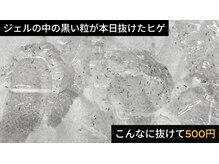 エピラージュ 町田店/爆抜けするヒゲ脱毛が500円