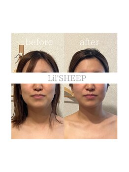 リルシープ(LIL'SHEEP)/眠れる小顔コルギ1回施術