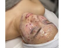 ビー ファクトリー(B FACTORY)/WAX後にハイドロジェリーマスク