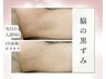 【脇/二の腕/お尻】色素取り◆ヒト幹細胞ハーブピーリング2g