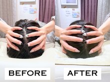 ビハリスト 麻布十番/頭のサイズからしっかり小顔に♪