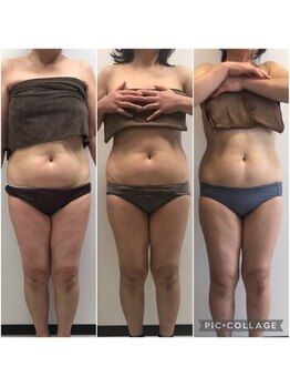 ビューティサロン ベルティア(Beltia)/#ダイエット#痩身#ブライダル