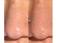 ビナリ 東銀座(BINARI)