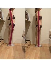 トトノエル(TOTONOEL)/姿勢矯正