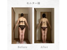 エメカシワ(Aimer KASHIWA)/30代　6ヶ月での変化