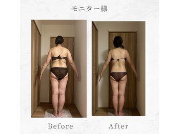 エメカシワ(Aimer KASHIWA)/30代　6ヶ月での変化