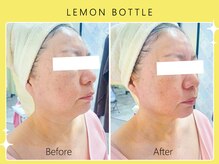 シロカネ イオンタウン西熊本店(SHIROKANE)/レモンボトル☆