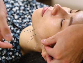 けやき台鍼灸整骨院の写真/【美容のお悩みも根本改善!】国家資格を持ったプロが一人一人に合った方法で骨と筋肉に的確にアプローチ◎