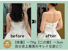 オンリ(ONRI)/ブライダルエステ★