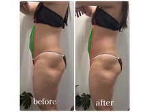 セリーナ 伊賀上野店(CELINA)の雰囲気（＜痩身エステ＞たった1回でもこんなに変わる！その場で痩せる♪）