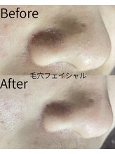 ベルミーランド MEGAドン・キホーテ桐生/フェイシャル　Before→After