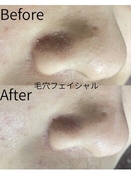 ベルミーランド MEGAドン・キホーテ桐生/フェイシャル Before→After