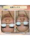 ジーンバイピエル 中野店(gene by PIEL)の写真/産毛と角質除去×LDMで鎮静/透明感とハリツヤ実感【中野/高円寺/新宿/水光肌/ツヤ肌/肌質改善】