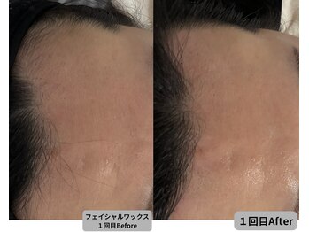 ミシル(Mishil)/