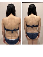 ラセラピー(RaTHERAPY)/ボディの変化