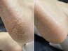 【ガサガサかかと卒業★】つるスベ♪《足裏角質ケアコース》¥6000→