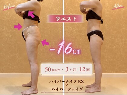 エピファニー(Epi phany Total Beauty Salon)の写真