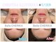 ベルチェリカ(Belle CHERIKA)の写真