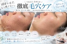 オンユ(ON’U)