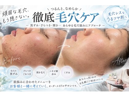 オンユ(ON’U)の写真