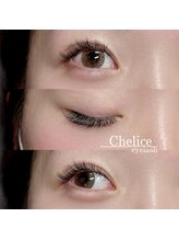 シェリス(Chelice)/施術者/ayaka