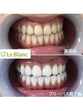 ルブラン 奈良店(Le Blanc)/かなりお得です！