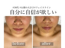 ディアンヌ(Diane)/ほうれい線/小顔コルギ/骨盤矯正