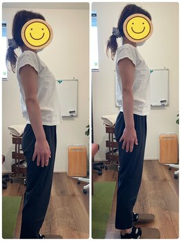 はた整体院/姿勢改善！