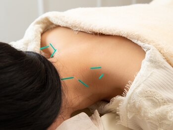 ココチ 中央林間(salon cocochi)/慢性的な肩こりにお悩みの方に◎