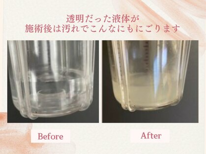 フェスティナ レンテ(Festina Lente)の写真