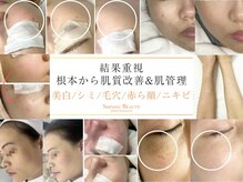 シャイニングビューティー 表参道(Shining Beauty)