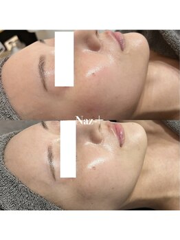 リベルテ(Liberte)/セレクト艶肌管理