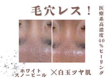 エステティック レイビス 銀座店(RAYVIS)/